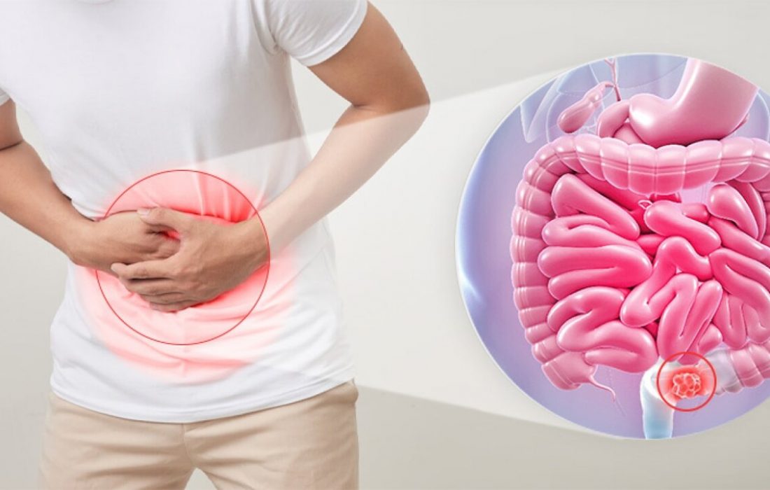 برای رفع یبوست این میوه‌ها را بخورید/ معرفی ۵ میوه ضد یبوست